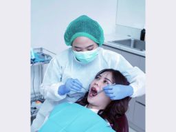 Implan Gigi Termurah Hadir di Indonesia, Semua Bisa Tanam Gigi