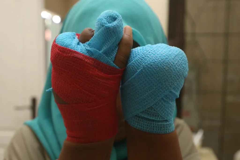 Melihat Kondisi Tangan Wiji Fitriani di RSJ Menur Surabaya